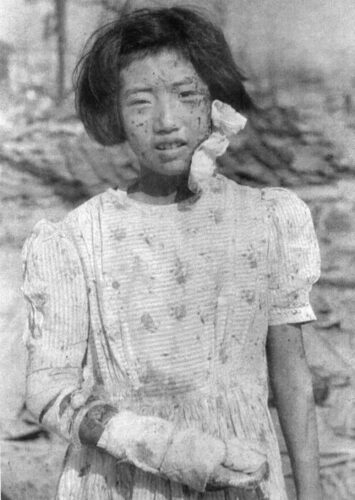  ガラスや砂のため顔一面に負傷した少女。撮影場所不明。少女の身元は当時10歳だった藤井幸子さんと判明し、毎日新聞2018年1月26日朝刊で報道＝1945年8月9日、国平幸男撮影（毎日新聞社提供）
